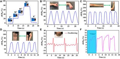 Ionic Conductive Organohydrogel With Ultrastretchability, Self-Healable and Freezing-Tolerant Properties for Wearable Strain Sensor